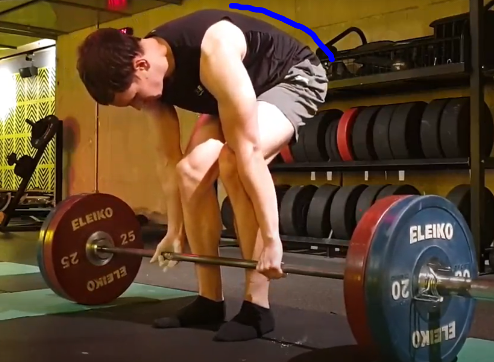rounded spine deadlift